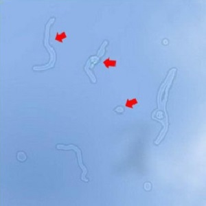 “好蚊子”大可不必煩惱