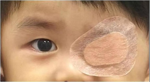 斜視,不僅,會,影響,兒童心理,發(fā)育,甚至,還會, 斜視,不僅,會,影響,兒童心理,發(fā)育,甚至,還會,