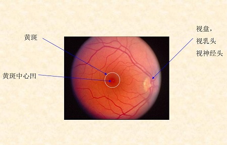 黃斑是什么,黃斑變性,黃斑病變,黃斑變性高發群 黃斑是什么,黃斑變性,黃斑病變,黃斑變性高發群