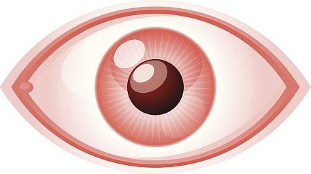 玻璃體混濁 玻璃體混濁