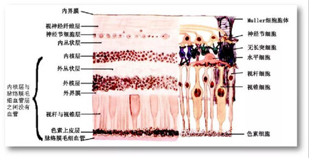 視網膜脫落,視網膜脫落癥狀,視網膜脫落治療 視網膜脫落,視網膜脫落癥狀,視網膜脫落治療