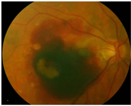 防紫外線,太陽鏡,墨鏡怎么選,防曬 防紫外線,太陽鏡,墨鏡怎么選,防曬