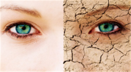 干眼癥,紅眼病,結膜炎,夏季眼病,眼睛防曬,紫外線 干眼癥,紅眼病,結膜炎,夏季眼病,眼睛防曬,紫外線