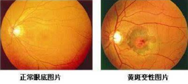 胬肉,角膜損傷,眼角膜,眼表 胬肉,角膜損傷,眼角膜,眼表