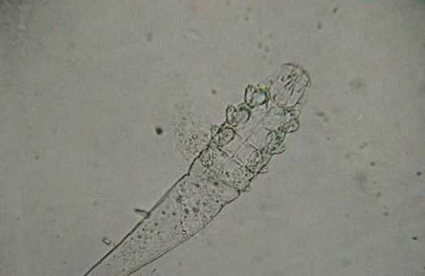 成也蕭何敗蕭何?|擁有主子的“人生贏家”卻輸在了眼睛上……